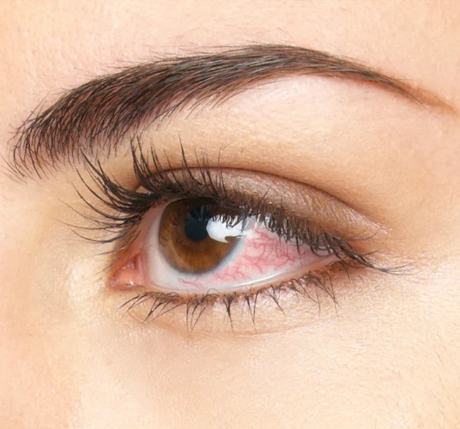 Allergies et gonflement après extensions de cils : comprendre les causes
      et adopter les bons gestes