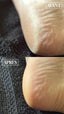 CALLUS CLEAN SOIN CALLOSITÉS DES PIEDS 500ML